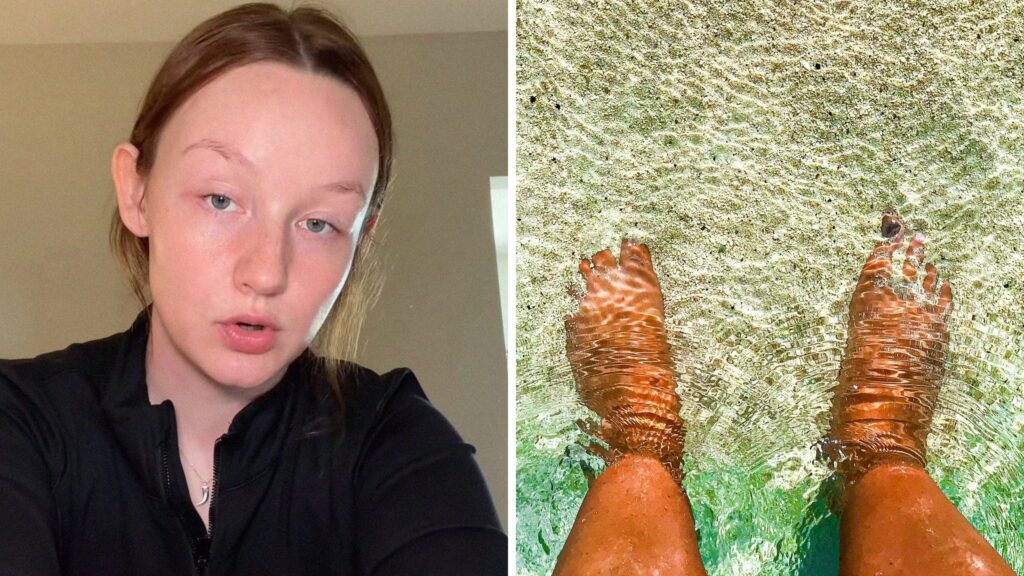 woman shares beach awareness (l) feet in beach (r)